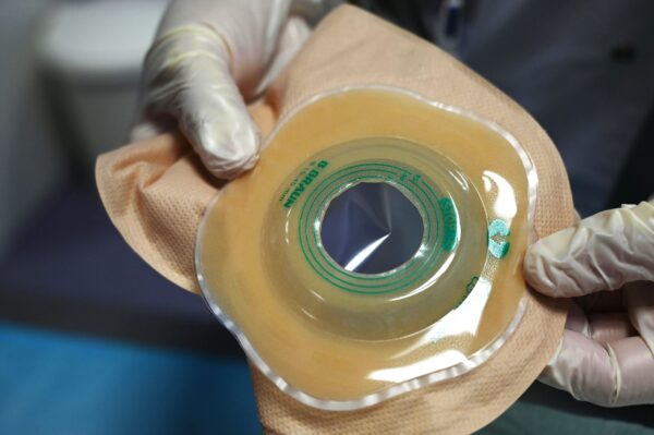 Ostomy - ADDEV Materials Healthcare